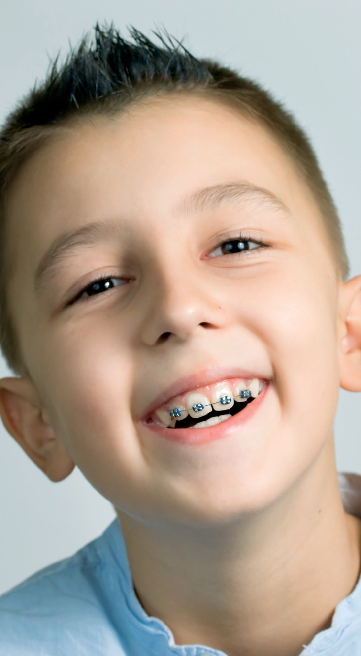 child smiling with braces
